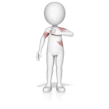 Figure with Itchy Rash PowerPoint Animation layout preview.