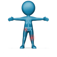 Custom Figure Pain Spot PowerPoint Animation layout preview.