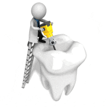 Dentist Chipping Away At Tooth PowerPoint Animation layout preview.