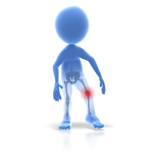 Stick Figure Knee Injury PowerPoint clipart graphic preview.