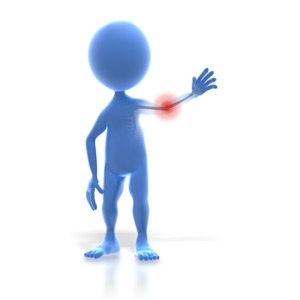 3D Stick Figure Arm Pain PowerPoint clipart graphic preview.
