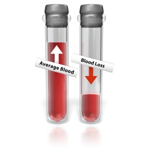 Test Tube Blood Loss PowerPoint clipart graphic preview.