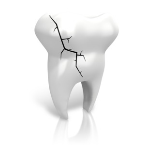 Cracked Tooth PowerPoint clipart graphic preview.