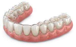 Invisible Teeth Correction PowerPoint clipart graphic preview.
