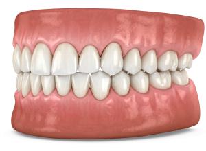 Teeth Profile PowerPoint clipart graphic preview.