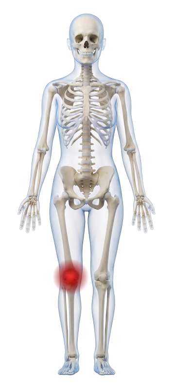 High-resolution customizable clipart of 3D Female Skeleton Front with Moveable Pain Points, designed for digital podcast broadcasting, multimedia content creation, and live entertainment event promotions.