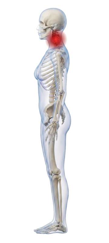 High-resolution customizable clipart of 3D Female Skeleton Side View with Moveable Pain Points, designed for clinical healthcare administration, medical training, and patient data visualization.